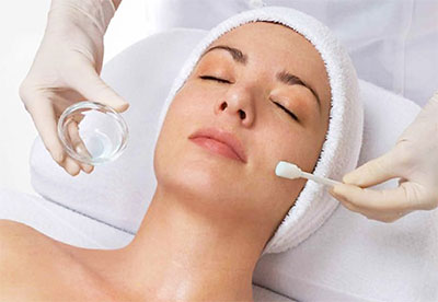 chemical-peel